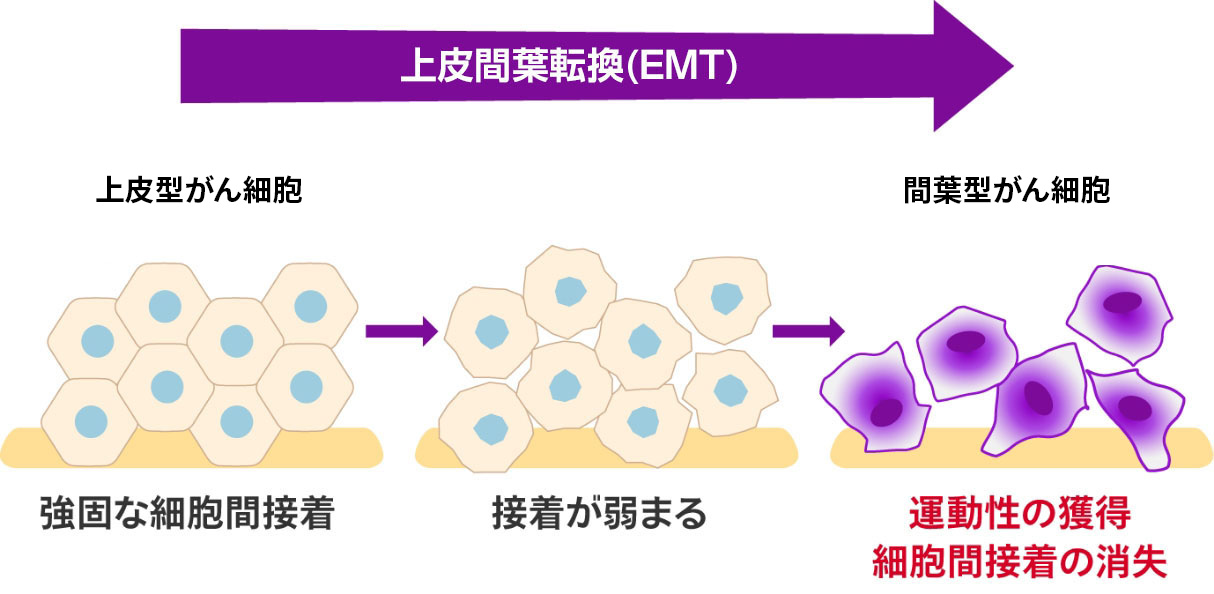 EMTが進行しがん細胞は間葉系へと悪性化していく
