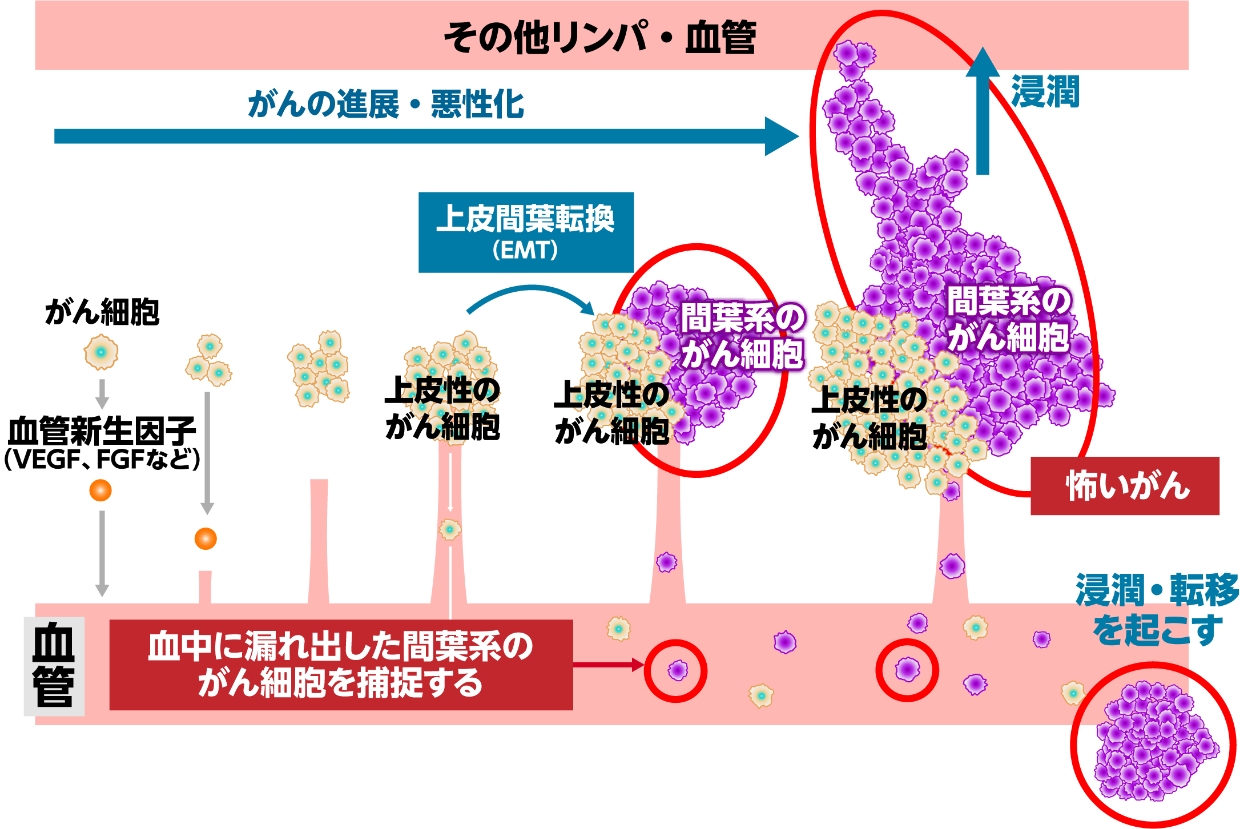 マイクロCTC検査は上皮間葉転換したCTCだけを捕捉